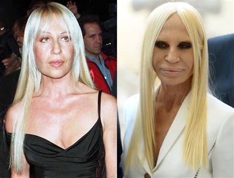 donatella versace santo versace|donatella versace before and after surgery.